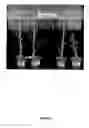Fig. 07 - Method for producing transgenic plants with increased yield, comprising expressing of haemoglobin from 