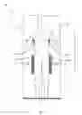 Fig. 02 - Patient repositioning device and method