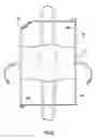 Fig. 07 - Contoured body support device