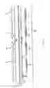 Fig. 15 - Support net for persons with fluid element, in particular water