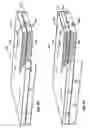 Fig. 18 - Reticulated material body support and method