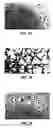 Fig. 03 - Reticulated material body support and method