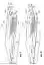 Fig. 20 - Reticulated material body support and method