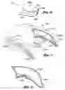 Fig. 04 - Removable hat accessory