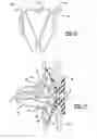 Fig. 06 - Resilient clip fastener