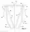 Fig. 10 - Resilient clip fastener