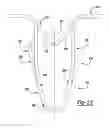 Fig. 15 - Resilient clip fastener
