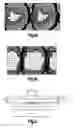 Fig. 02 - Coaxial via structure for optimizing signal transmission in multiple layer electronic device carriers