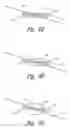 Fig. 06 - Reversibly disengaging slidable strike indicator, positioning system, and method of using same