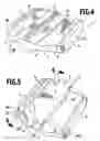 Fig. 04 - Surgical saw guide
