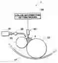 Fig. 01 - Method of and system for stencil printing and ink container