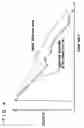 Fig. 05 - Ignition timing control device of internal combustion engine