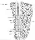 Fig. 49 - Tools and methods for making and using tools, blades and methods of making and using blades