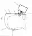 Fig. 03 - Air purifying escape hood