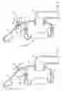 Fig. 03 - Forehead support for facial mask