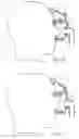 Fig. 04 - Forehead support for facial mask