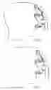 Fig. 05 - Forehead support for facial mask