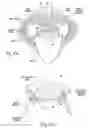 Fig. 10 - Devices, systems, and methods using magnetic force systems in or on tissue in an airway