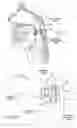 Fig. 27 - Devices, systems, and methods using magnetic force systems in or on tissue in an airway