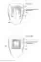 Fig. 23 - Magnetic devices, systems, and methods placed in or on a tongue