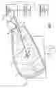Fig. 02 - Concrete mixer drum cleaner
