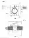 Fig. 03 - Methods of making medical devices