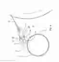 Fig. 04 - Composite doctor arrangement