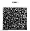 Fig. 09 - Implants with textured surface and methods for producing the same