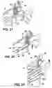 Fig. 09 - Tamper-resistant container with tamper-evident feature and method of forming the same