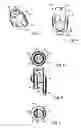 Fig. 03 - Nozzle flow splitter