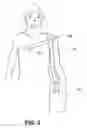 Fig. 04 - Carrying aid device
