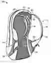 Fig. 01 - Backpack having distributed-load shoulder strap system