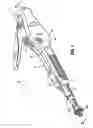 Fig. 02 - End-to-end anastomosis instrument and method for performing same