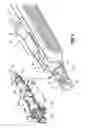 Fig. 06 - End-to-end anastomosis instrument and method for performing same