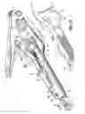 Fig. 10 - End-to-end anastomosis instrument and method for performing same