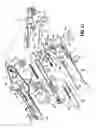 Fig. 11 - End-to-end anastomosis instrument and method for performing same