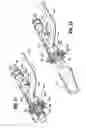 Fig. 16 - End-to-end anastomosis instrument and method for performing same