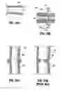Fig. 17 - End-to-end anastomosis instrument and method for performing same