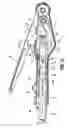 Fig. 19 - End-to-end anastomosis instrument and method for performing same