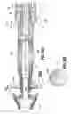 Fig. 23 - End-to-end anastomosis instrument and method for performing same