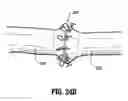 Fig. 25 - End-to-end anastomosis instrument and method for performing same