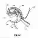 Fig. 27 - End-to-end anastomosis instrument and method for performing same