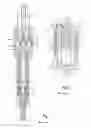 Fig. 02 - Fuel-injection valve
