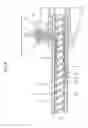 Fig. 06 - Method of removing surface material from resin product and apparatus therefor