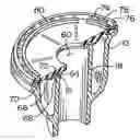 Fig. 01 - Flush valve diaphragm orifice insert and rib design