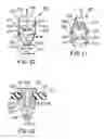 Fig. 05 - Flush valve diaphragm orifice insert and rib design
