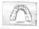 Fig. 01 - Dental crowns