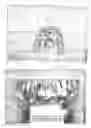 Fig. 02 - Dental crowns