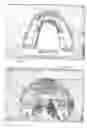 Fig. 03 - Dental crowns