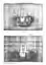 Fig. 08 - Dental crowns